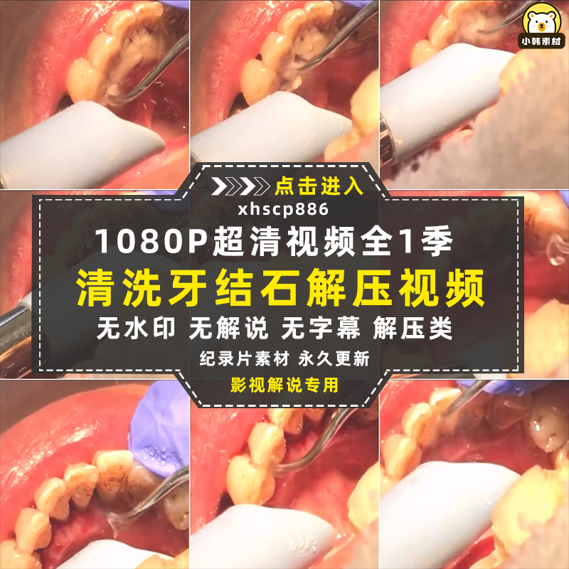 生活解压纪录片清洗牙结石全1季中视频自媒体解说高清视频素材插图